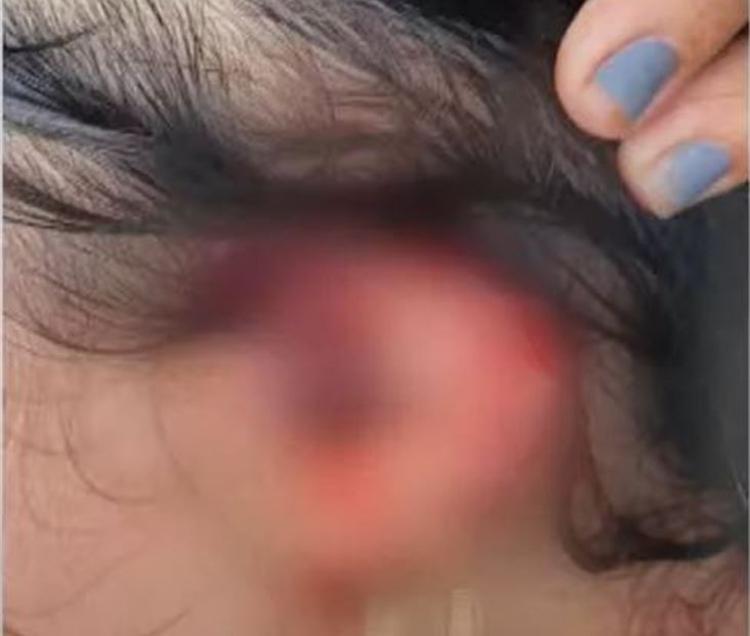 Mulher é atacada pelo marido e tem orelha cortada no Amazonas